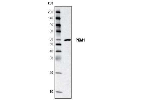 Western Blotting Image 1: PKM1/2 Antibody