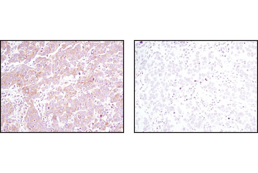 Immunohistochemistry Image 2: Pyruvate Dehydrogenase (C54G1) Rabbit mAb