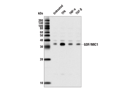 Western Blotting Image 1: GDF15/MIC1 (L300) Antibody