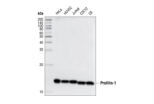 Western Blotting Image 1: Profilin-1 Antibody