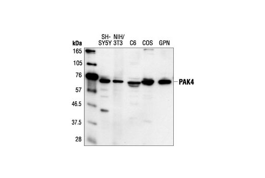 Western Blotting Image 1: PAK4 Antibody