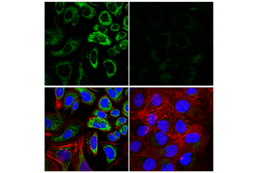 Immunofluorescence Image 3: FIS1 (E3K9O) Rabbit mAb