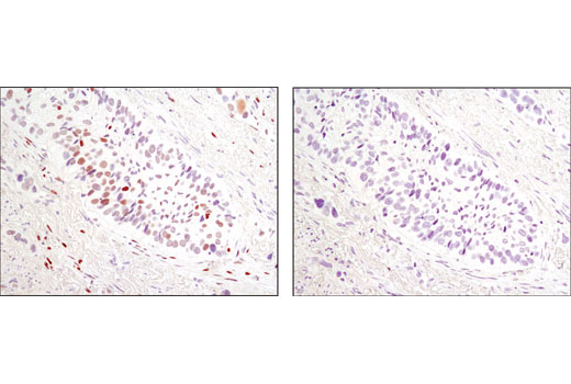  Image 14: PhosphoPlus® c-Jun (Ser63) and c-Jun (Ser73) Antibody Kit