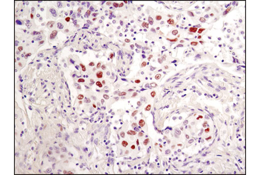  Image 11: PhosphoPlus® c-Jun (Ser73) Antibody Duet