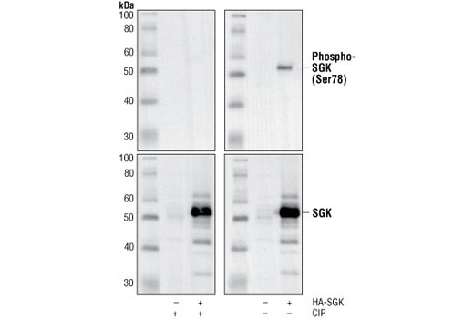 Western Blotting Image 1: Phospho-SGK (Ser78) Antibody