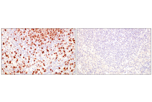 Immunohistochemistry Image 4: CD7 (E4G1Q) XP® Rabbit mAb (BSA and Azide Free)