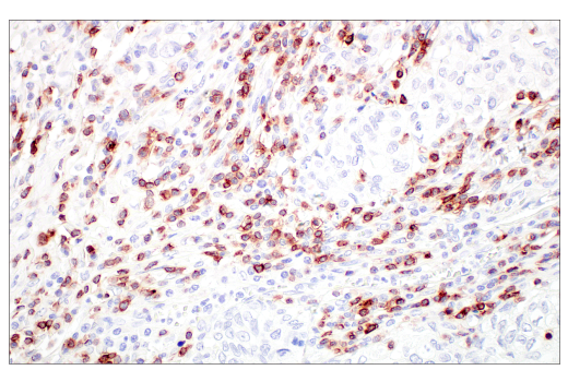 Immunohistochemistry Image 9: CD7 (E4G1Q) XP® Rabbit mAb (BSA and Azide Free)