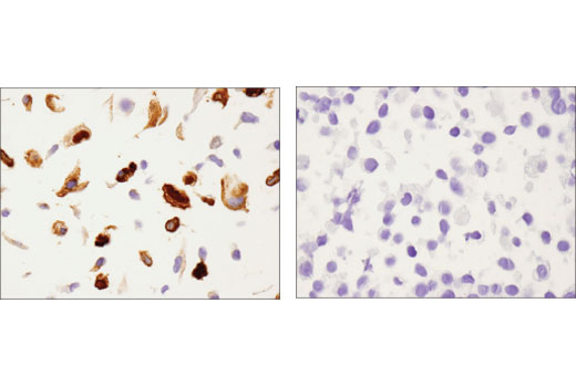 Immunohistochemistry Image 3: Annexin A1 (D5V2T) XP® Rabbit mAb (BSA and Azide Free)