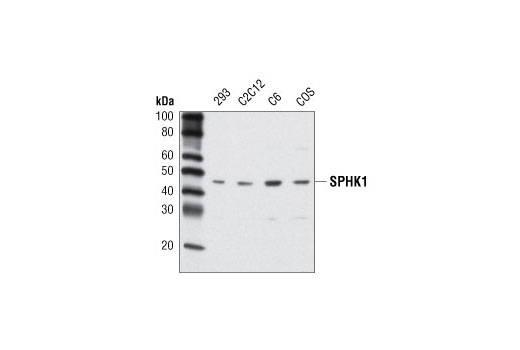Western Blotting Image 1: SPHK1 Antibody