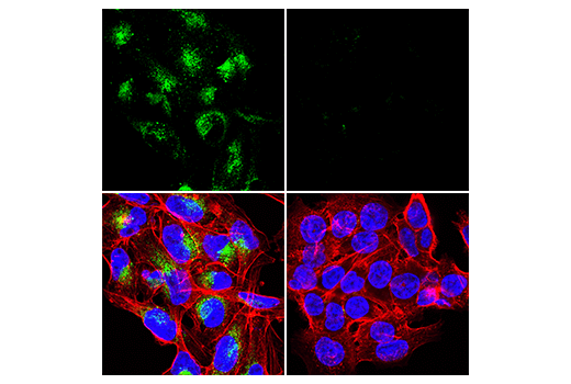 Immunofluorescence Image 1: Tenascin C (E5J3B) Rabbit mAb