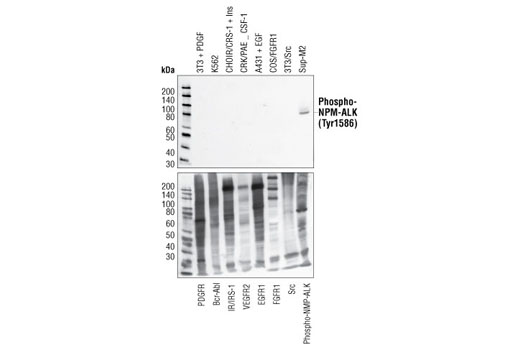Western Blotting Image 1: Phospho-ALK (Tyr1586) Antibody