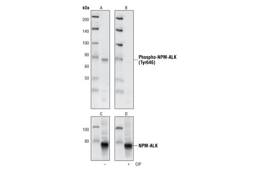  Image 8: ALK Activation Antibody Sampler Kit