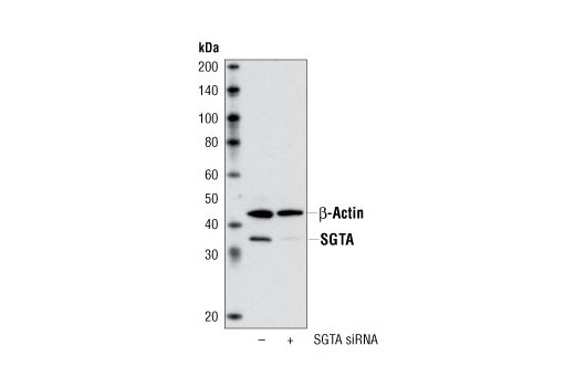 Western Blotting Image 1: SGTA Antibody