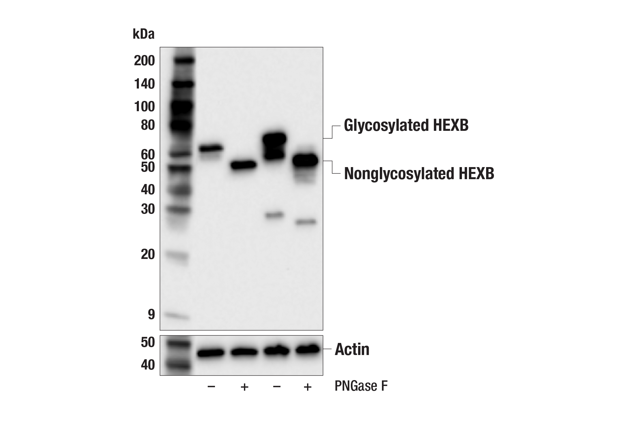 Hexb E X S Rabbit Mab Cell Signaling Technology