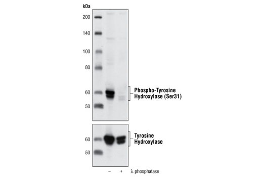 Western Blotting Image 1: Phospho-Tyrosine Hydroxylase (Ser31) Antibody
