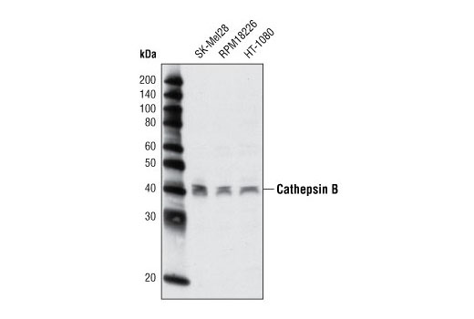 Western Blotting Image 2: Cathepsin B (G60) Antibody