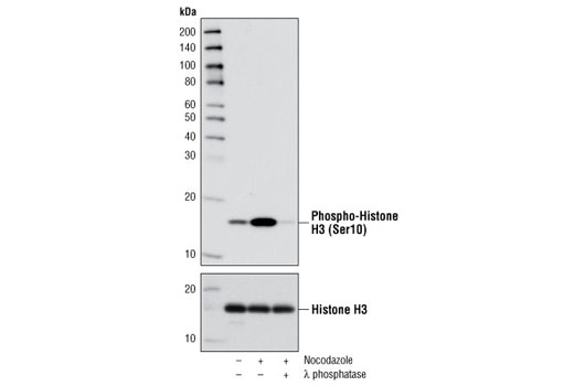  Image 4: Cell Cycle Regulation Antibody Sampler Kit II
