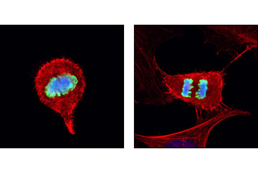  Image 4: PhosphoPlus® Histone H3 (Ser10) Antibody Duet