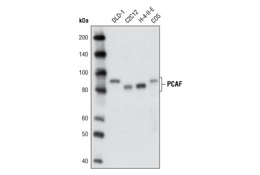  Image 4: Lysine Acetyltransferase Antibody Sampler Kit