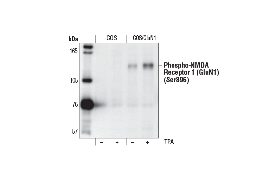 Western Blotting Image 1: Phospho-NMDA Receptor 1 (GluN1) (Ser896) Antibody