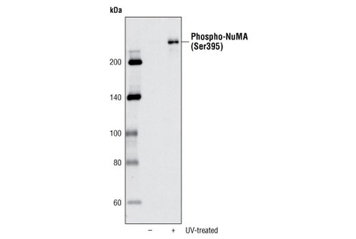 Western Blotting Image 1: Phospho-NuMA (Ser395) Antibody