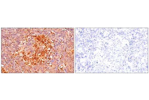  Image 55: Phospho-Tau (Ser214/T217) Signaling Antibody Sampler Kit