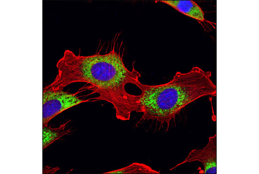  Image 20: ER and Golgi-Associated Marker Proteins Antibody Sampler Kit