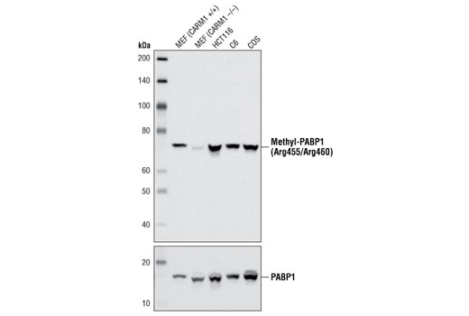Western Blotting Image 1: Asymmetric-Methyl-PABP1 (Arg455/Arg460) (C60A10) Rabbit mAb
