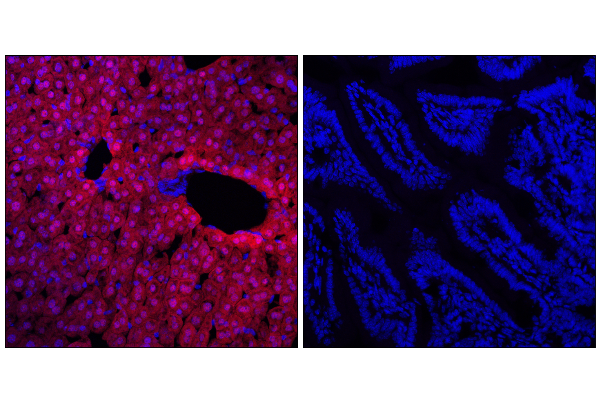 Immunofluorescence Image 1: Arginase-1 (D4E3M™) XP® Rabbit mAb (Alexa Fluor® 555 Conjugate)