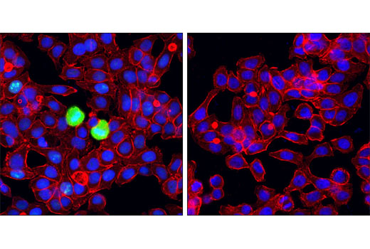 Immunofluorescence Image 1: Phospho-NPM1 (Thr199) Antibody