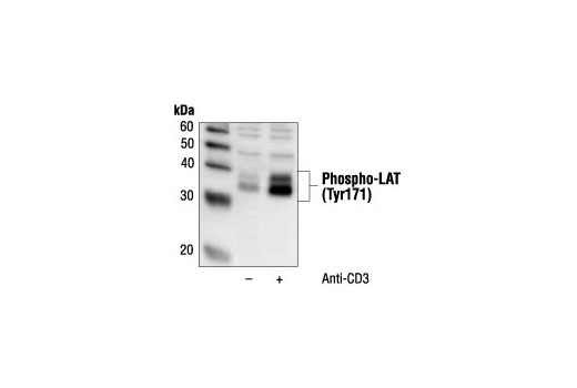 Western Blotting Image 1: Phospho-LAT (Tyr171) Antibody