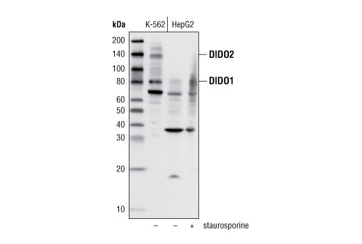 Western Blotting Image 2: DIDO1 Antibody