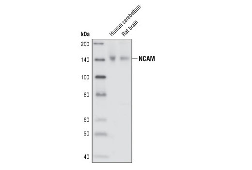 Western Blotting Image 1: NCAM (CD56) Antibody