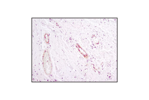  Image 3: PhosphoPlus® Notch1 (Cleaved, Val1744) Antibody Duet