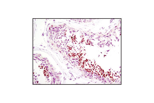 Immunohistochemistry Image 3: NUT (C52B1) Rabbit mAb
