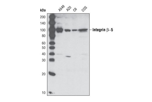 Western Blotting Image 1: Integrin β5 (D24A5) Rabbit mAb