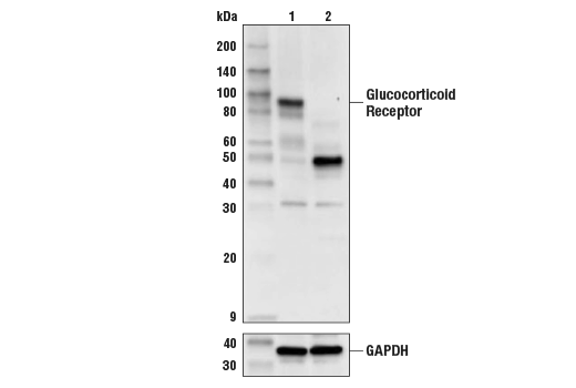  Image 35: Nuclear Receptor Antibody Sampler Kit
