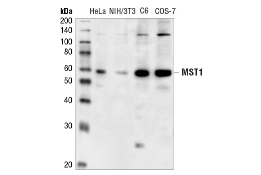 Western Blotting Image 1: MST1 Antibody