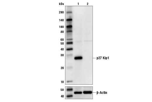  Image 11: Cell Cycle Regulation Antibody Sampler Kit