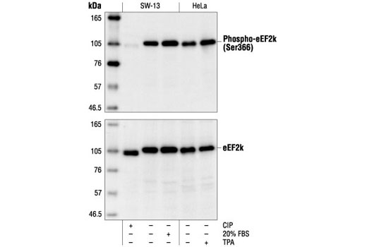 Image 8: p70 S6 Kinase Substrates Antibody Sampler Kit