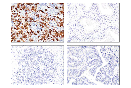 Immunohistochemistry Image 1: LIN28A (D84C11) XP® Rabbit mAb