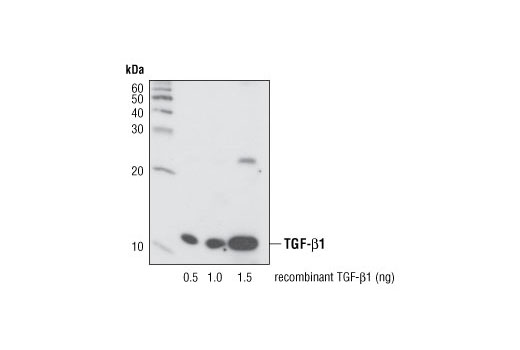  Image 7: TGF-β Fibrosis Pathway Antibody Sampler Kit