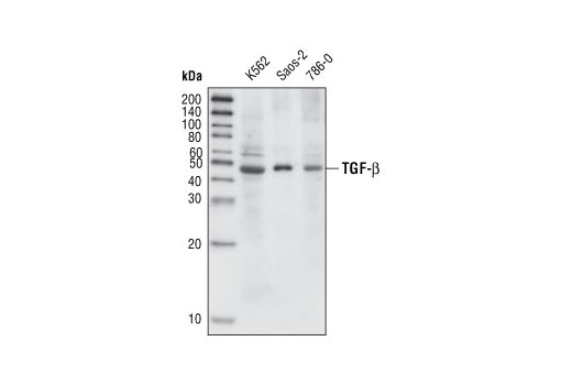 Image 26: TGF-β Fibrosis Pathway Antibody Sampler Kit