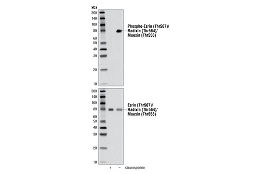  Image 15: Actin Reorganization Antibody Sampler Kit