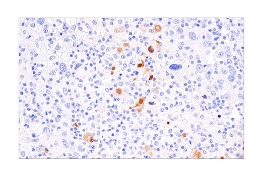 Immunohistochemistry Image 4: CXCL9/MIG (E6Z5W) Rabbit mAb (BSA and Azide Free)