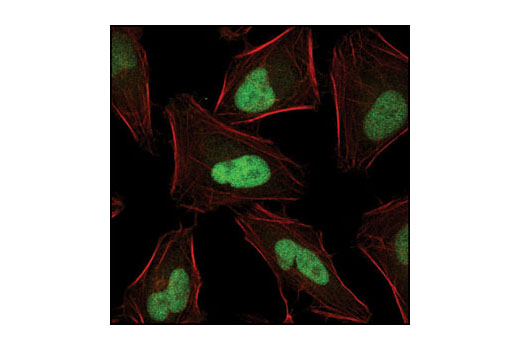 Immunofluorescence Image 1: JunB (P169) Antibody
