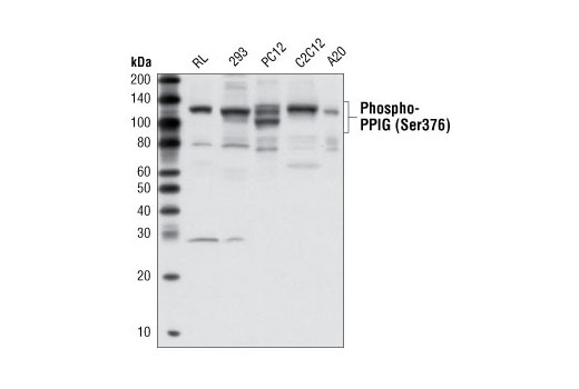 Western Blotting Image 2: Phospho-PPIG (Ser376) Antibody
