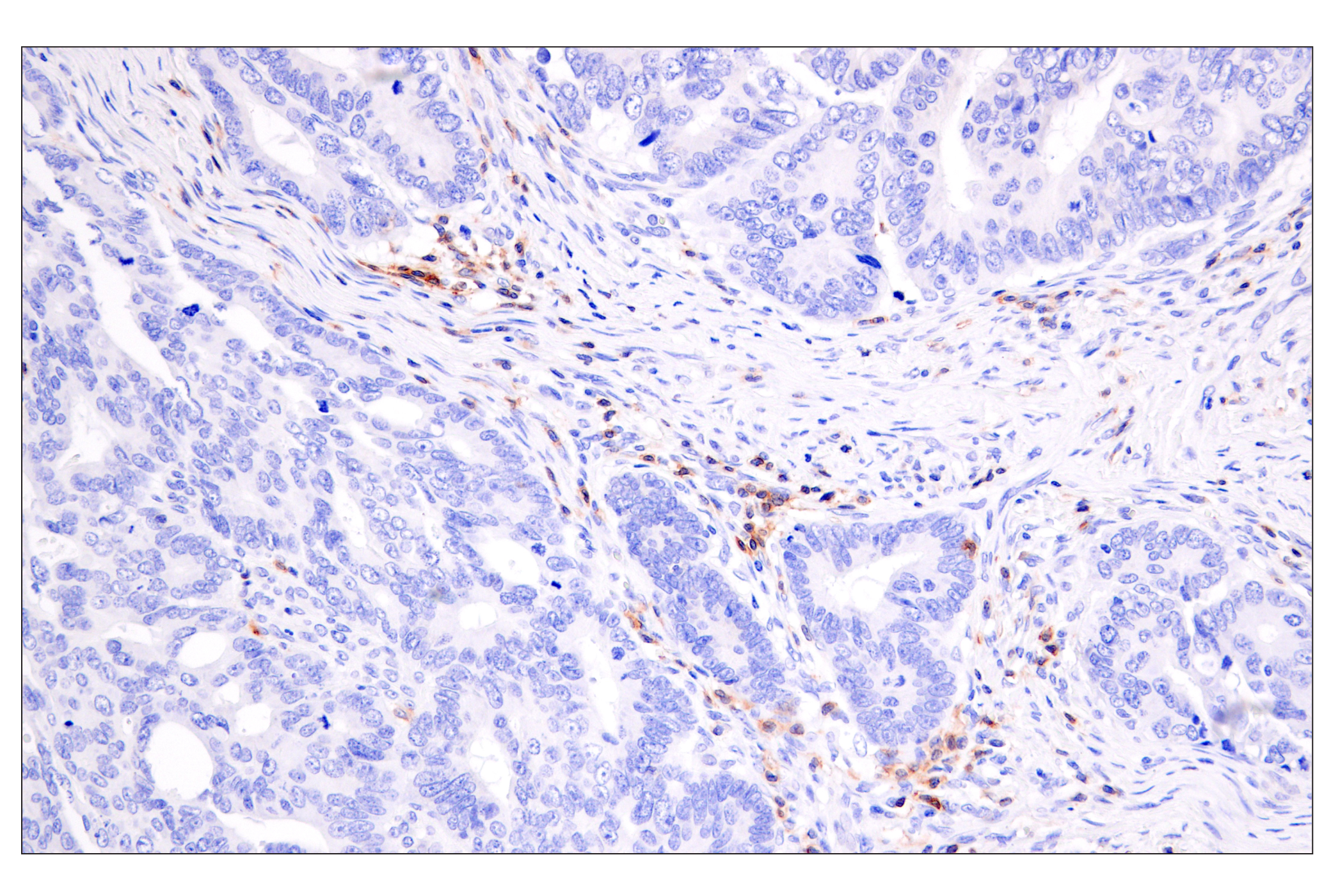Immunohistochemistry Image 2: CD28 (D2Z4E) Rabbit mAb