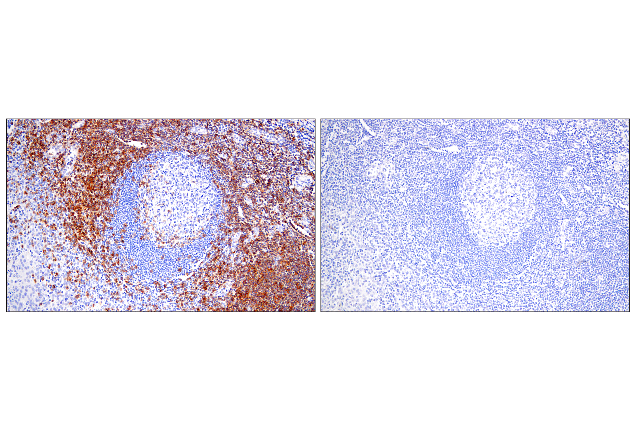 Immunohistochemistry Image 8: CD28 (D2Z4E) Rabbit mAb
