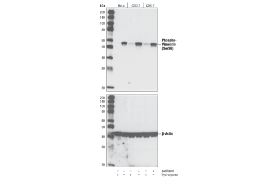 Western Blotting Image 1: Phospho-Vimentin (Ser56) Antibody